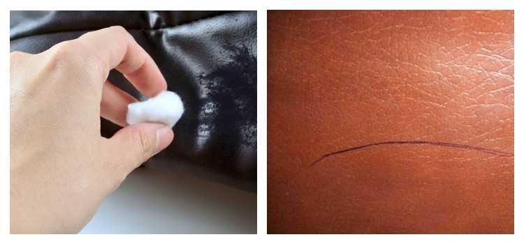 Чем оттереть ручку с кожи: как убрать чернила от шариковой, чем можно вывести пятна от гелевой, как отстирать с изделий белого цвета?